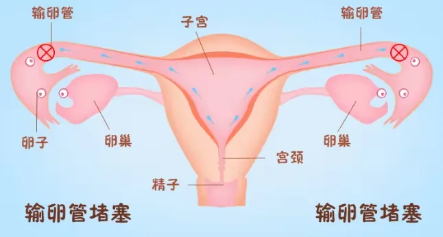 备孕总失败？打通&ldquo;生命通道&rdquo;，深圳港龙医院专家一招科学助孕！